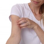 аллергия на алкоголь симптомы