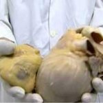 Что будет если пить много пива