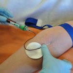 Ферментный анализ