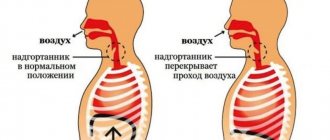 Как остановить икоту после алкоголя